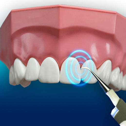 Met 3000 trillingen/min. bereikt u de kleinste ruimtes tussen uw tanden.